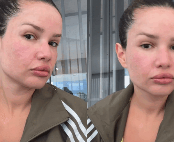 Juliette mostra resultado de procedimento estético com esperma de salmão