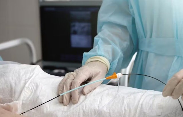 Ablação: entenda o procedimento utilizado para tratar arritmia de Caiado